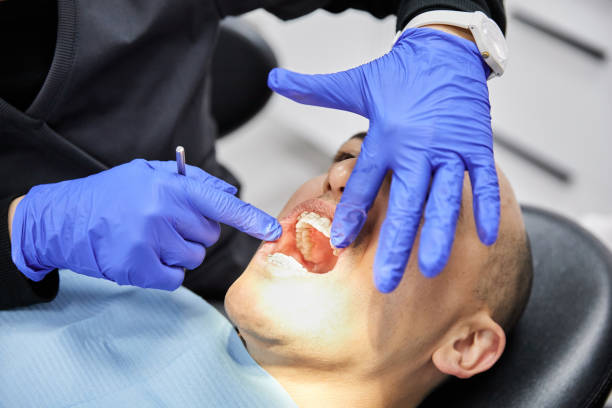 Best Emergency Root Canal Therapy in Bladensburg, MD